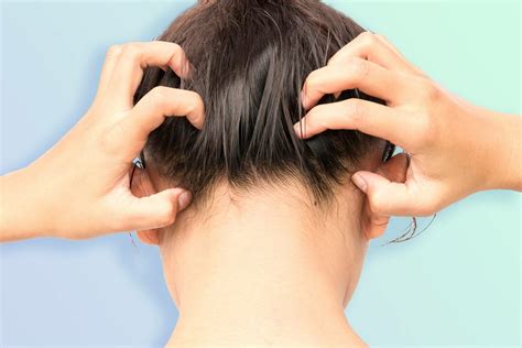 Itchy inflammed scalp .